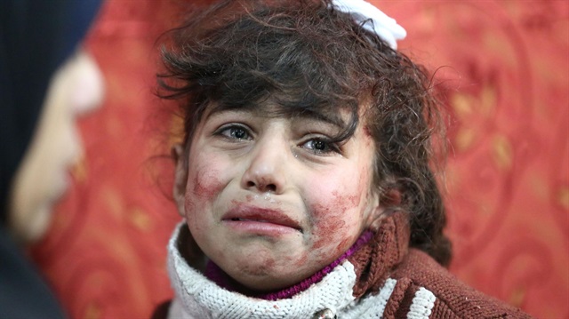 Esed rejimi, abluka altında tuttuğu Doğu Guta'ya yönelik saldırılarını sürdürüyor. Saldırılarda yaralanan bir kız çocuğu... 