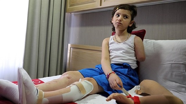 "ريان" طفلة سورية ​تستعيد خطواتها في تركيا بعد حرمانها من المشي!