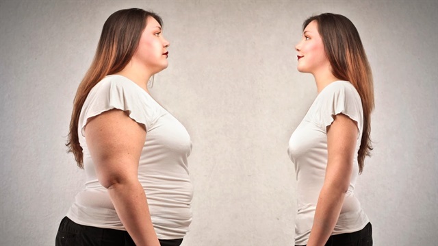 Obezite ameliyatları hormonal nedenlerle kilo alanlar için uygun değildir. 
