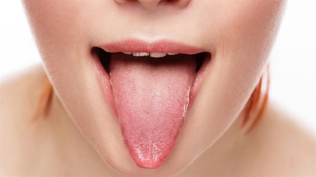 ​Dilinizde çıkan yara kanser belirtisi olabilir. 