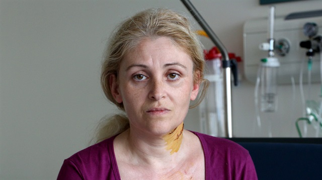 Eşinin bıçakla yaraladığı kadın: Boğazımı kesmeye çalıştı