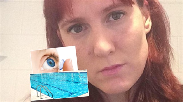 Havuza gözünde lensle giren kadın gözünün mikrop kapması sonucu kör oldu.