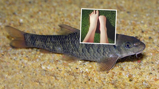 Ölü deri yiyen balıkların olduğu havuza giren genç kız ayak parmaklarını kaybetti. 
