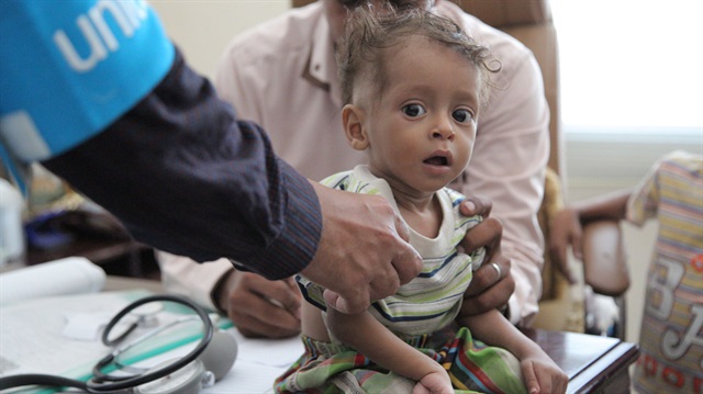 Yemen'de çocukların ağlayacak gücü yok