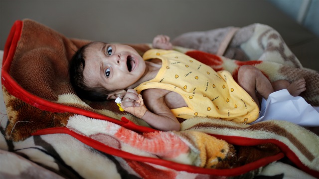Yemen'de 22 milyondan fazla insan yardıma ve korumaya ihtiyacı var.