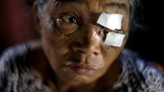 Endonezya'nın Sulawesi Adası'nda meydana gelen 7.4  büyüklüğündeki depremde yaralanan yaşlı bir kadın. Fotoğraf: Reuters)