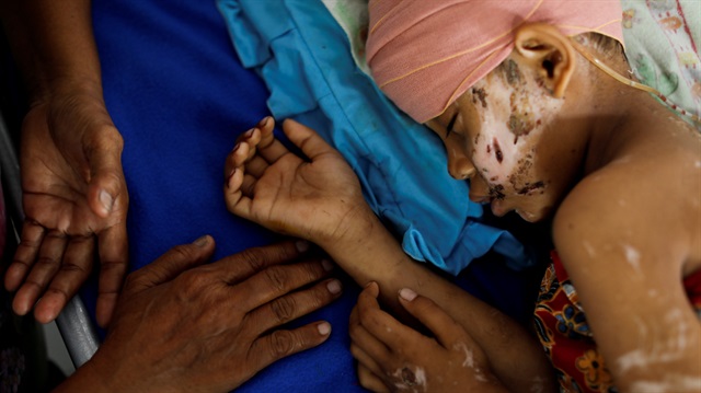 Endonezya'daki depremde yaralanan bir çocuk tedavi ediliyor. 