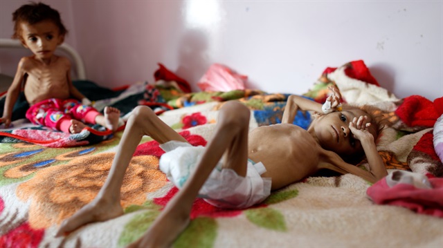 Arşiv: Yemen'deki gıda sıkıntısı en çok çocukları etkiliyor