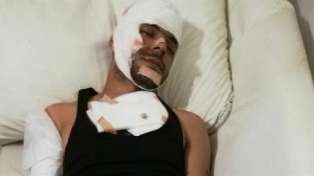 Ahmet B., yakın arkadaşlarına sosyal medyadan kafası, kolu ve göğsünün sargı beziyle sarılmış fotoğrafını paylaştırdı. 