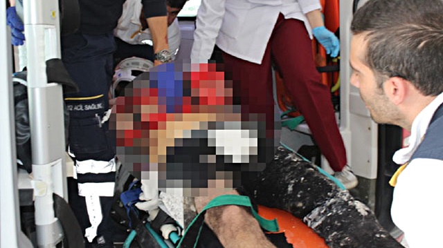 Yaralanan işçi, ambulansla hastaneye kaldırıldı. 