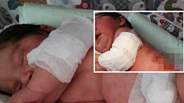 18 gün boyunca yoğun bakımda kalan bebeğin anne sütü alamadığı da ortaya çıktı.