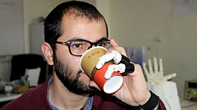 Mühendislik öğrencisi Muhammet Avad, yaptığı protez parmakla elini kullanabiliyor.