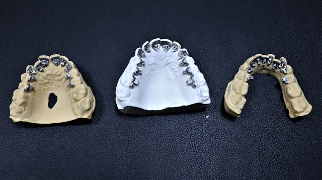 İthal edilen yüksek maliyetli diş teli Van'da üretildi