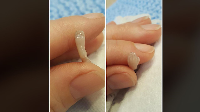 Ölü doğan bebeğin görüntülerini sosyal medyada paylaştılar. 