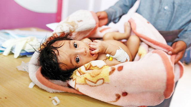 Yemen'deki savaştan en çok etkilenenler çocuklar. Açlıkla boğuşan çocuk sayısının 5.2 milyon olduğu belirtiliyor.