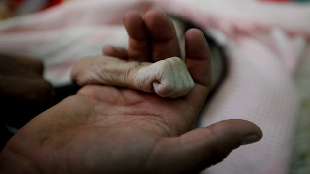 Yemen'de yeni doğmuş bir bebek. 