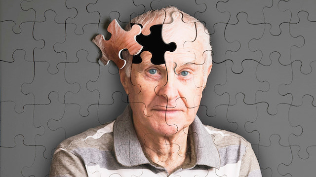 Alzheimer hastalığı beyne 25 yıl önce yerleşiyor ve yıllar sonra unutkanlık başlıyor.