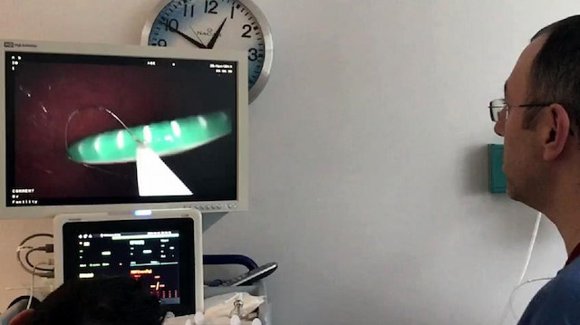 Midesi bulanan genç kadın kusmak için boğazına soktuğu diş fırçasını yuttu.