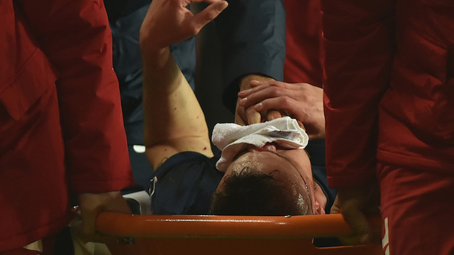Fenerbahçe maçında burnu kırıldı