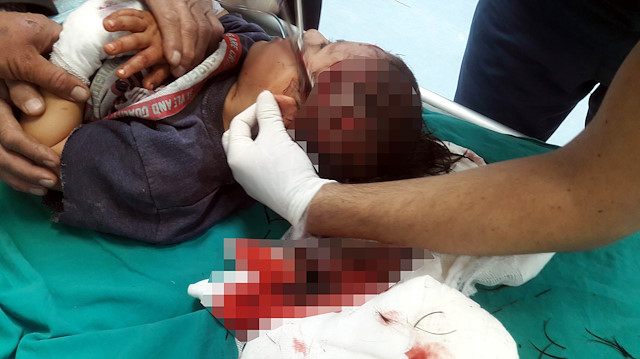 4 yaşındaki Ahmet Hakan A başından ağır yaralandı.