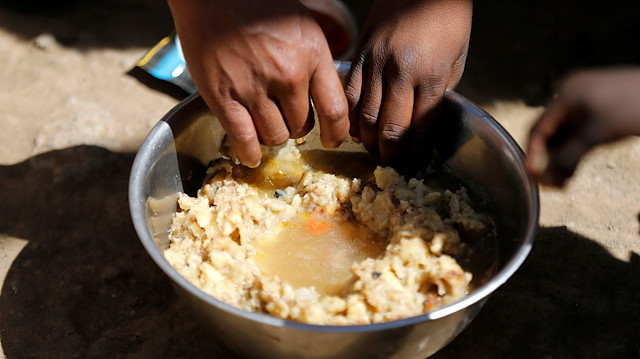 Yemen'de 358 bin çocuk akut yetersiz beslenme mağduru.