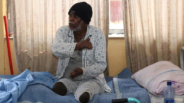 مرضى الجذام بإثيوبيا.. ألم العجز ومرارة العزلة