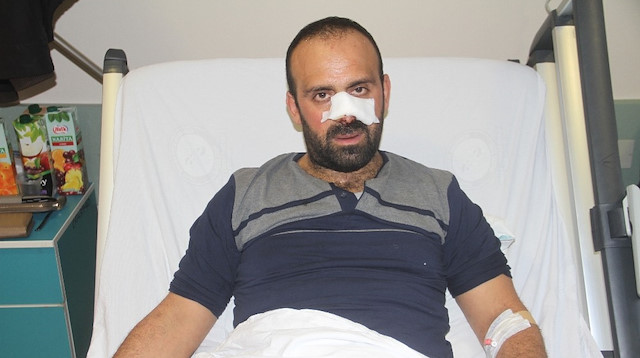 3 köpeğin saldırısına uğrayıp burnu ve bacağı parçalanan Mehmet Yıldırım, tedavi altına alındı.