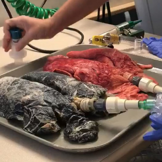 saglikli akciger ve sigara icen kisinin akcigeri yeni safak