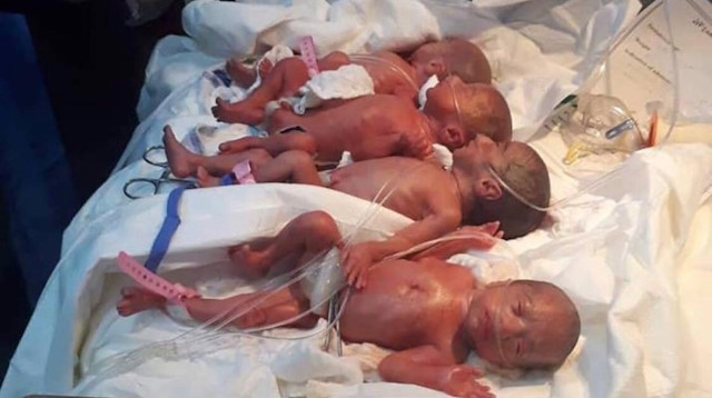 Normal doğumla dünyaya gelen yediz bebeklerin sağlık durumu iyi.