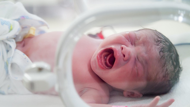 Uzmanlar, yeni doğan bebeklerin tuzlanmaması için uyardı.