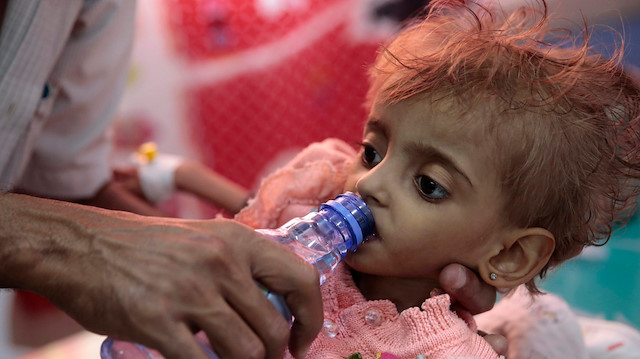 Yemen'de milyonlarca çocuk gıda sıkıntısı çekiyor.