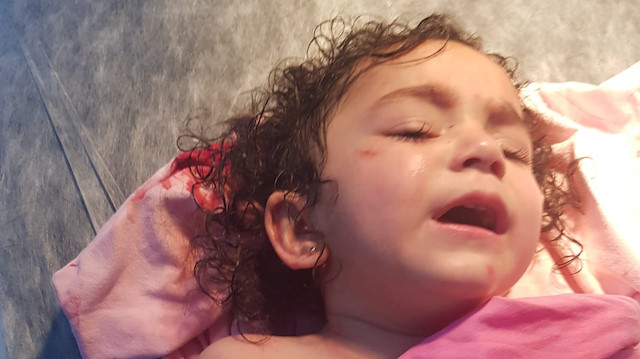 adana da 2 yasinda cocuga kopek saldirdi basibos kopekler saldirdi yeni safak