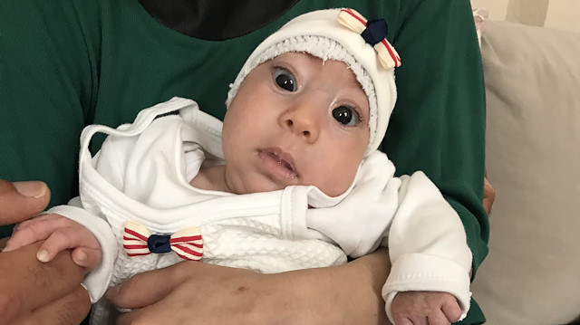 Arzu ve Ali Akın Hıdır çiftinin "cranium bifidum" hastası olan 2 aylık kızları Elif sağlığına kavuşuyor.
