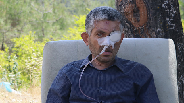 Hatay'da yaşayan ve amilyat olan Mustafa Bulat'ın tedavisine evine devam ediliyor.