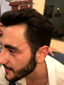 Mehmet Akif Yaman, İstinye Devlet Hastanesine giderek darp raporu aldı.
