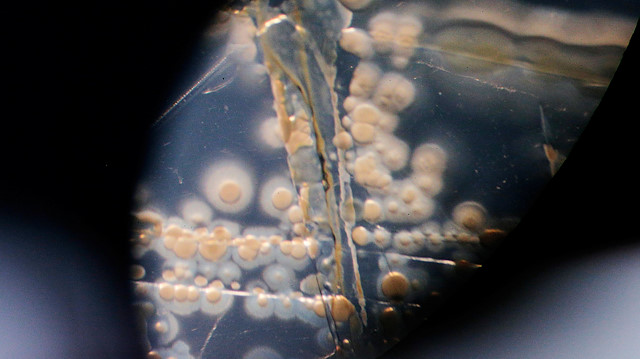 A microscope shows the bacterium Eleftheria terrae