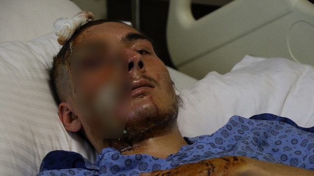 Trafik kazası geçiren ve tanınmayacak hale gelen 22 yaşındaki İbrahim Gökhan Kayalı.