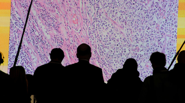 Cancer cells are seen on a large screen connected to a microscope 