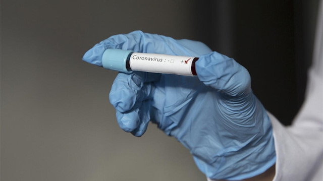 💊💉 Çin'de koronavirüsü 15 dakikada tespit eden kit geliştirildi