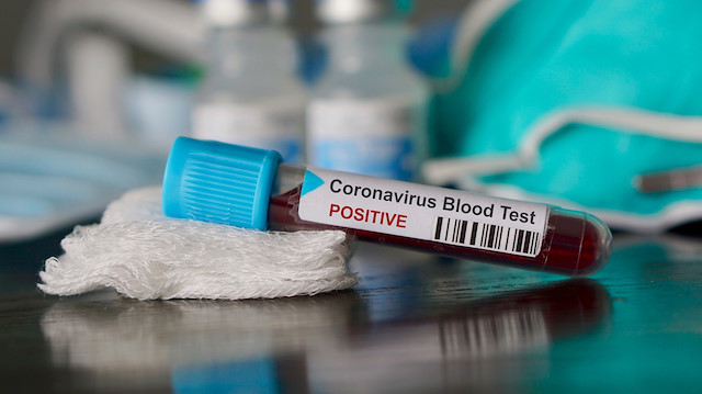 Koronavirüs bir ülkede daha görüldü, bilinen 2 vakadan söz ediliyor