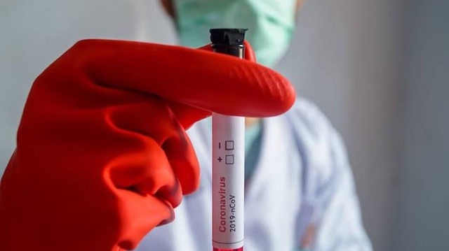 Çin duyurdu: Koronavirüs için aşıyı bulduk 💉
