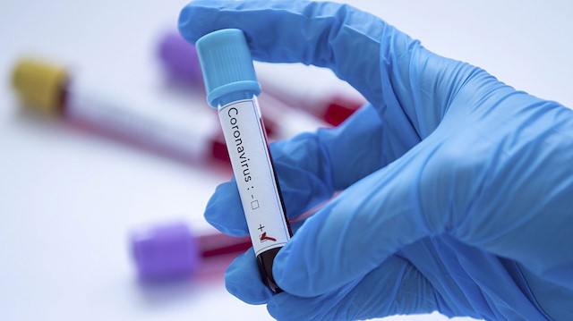 Ülkede 17 kişide koronavirüs tespit edildi.

