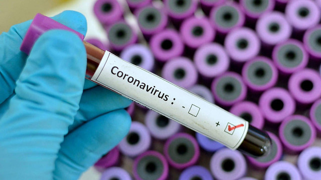 Koronavirüs, her geçen gün daha fazla ülkeye yayılıyor. 