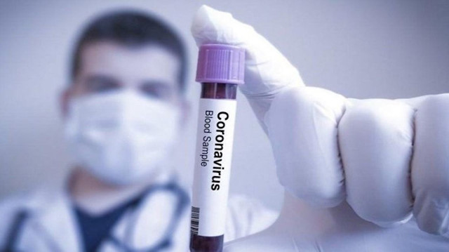 Koronavirüse karşı 14 gün kuralı nedir? Evde uygularken nelere dikkat edilmeli?