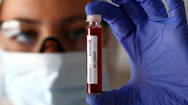 Türk bilim insanları geliştirdi: Koronavirüsü 10 dakikada tespit ediyor