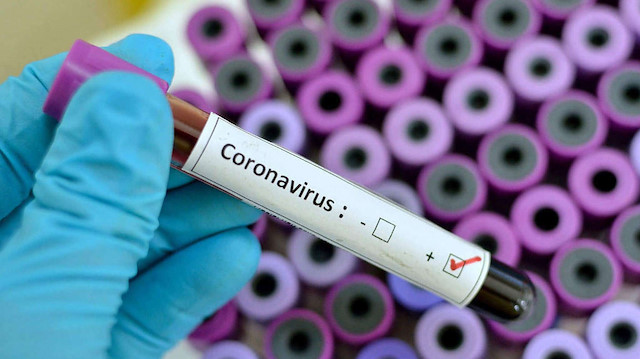 Koronavirüs salgınını canlı haritalarda takip edebileceğiniz 5 servis