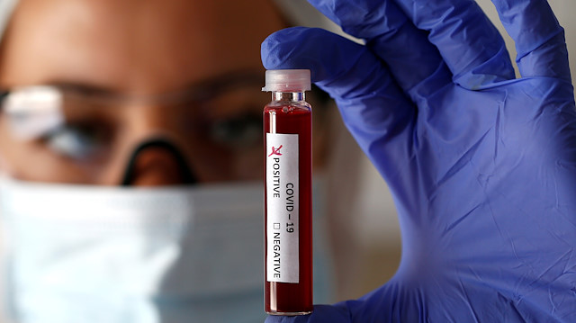 FILE PHOTO: Fake blood is seen in test tubes labelled with the coronavirus (COVID-19) in this illustration taken March 17, 2020