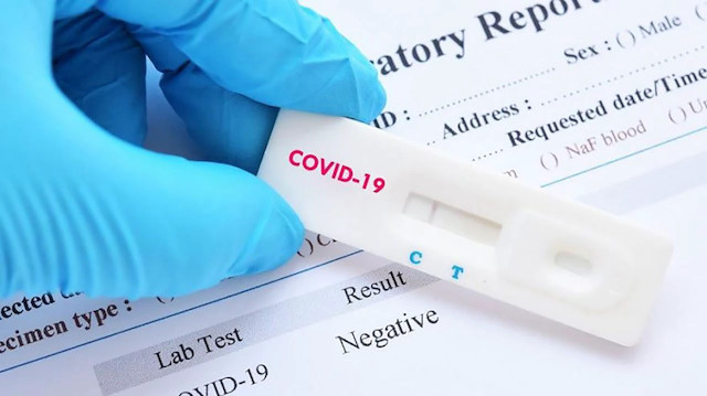 ABD'den iki dakikada sonuç veren koronavirüs testine onay