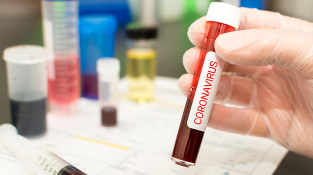 Koronavirüs testlerinde yeni dönem: Hasta hakkında birçok bilgi veriyor