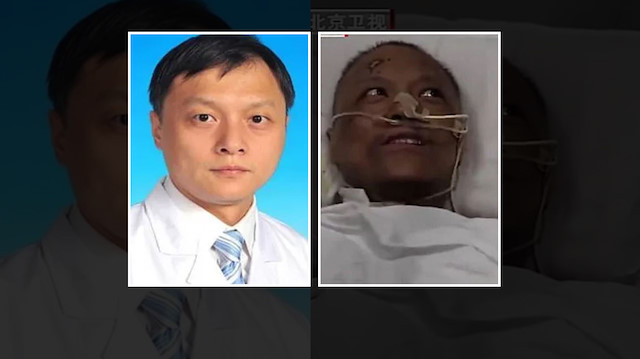 Çin'de iki doktorun koronavirüs sonrası ten rengi değişti.
